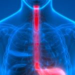 Mazzarello<br>La Disfagia