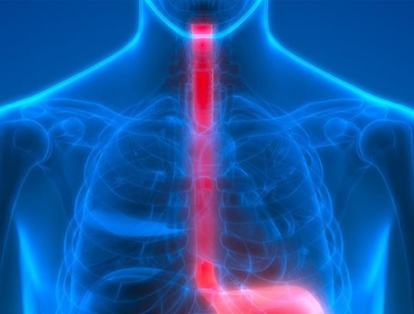 Mazzarello<br>La Disfagia