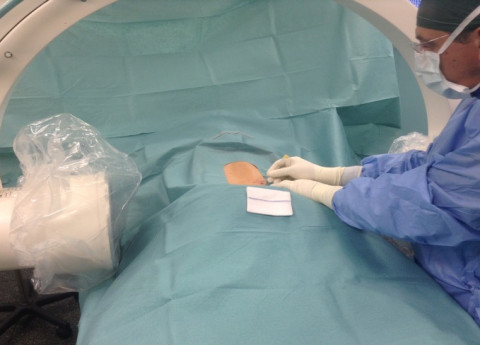 Ernia del disco: una nuova tecnica laser nella live surgery di Kinetika