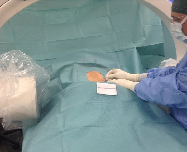 Ernia del disco: una nuova tecnica laser nella live surgery di Kinetika