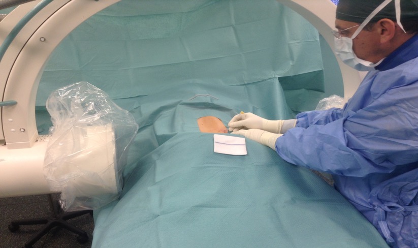 Ernia del disco: una nuova tecnica laser nella live surgery di Kinetika