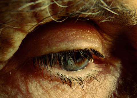 Alzheimer: sintomi, cura e consigli per gli Anziani