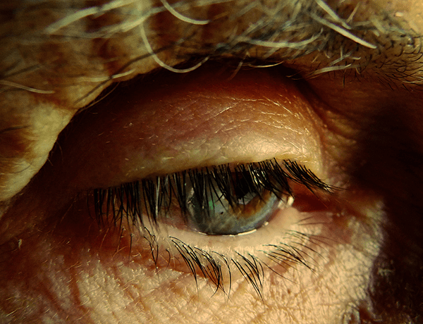 Alzheimer: sintomi, cura e consigli per gli Anziani