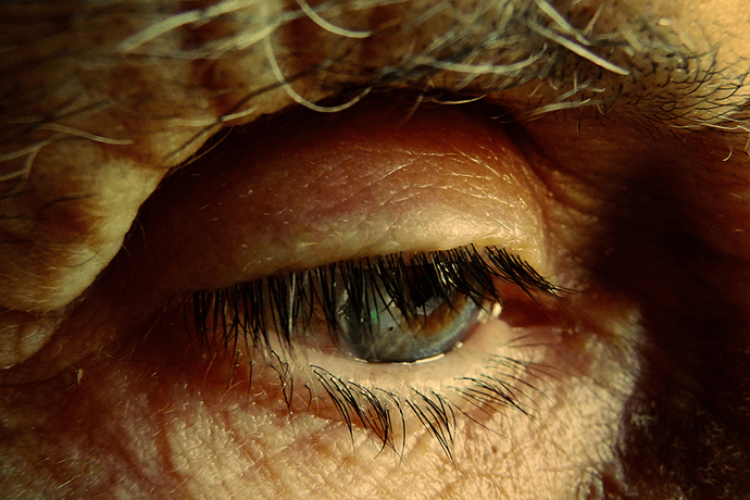 Alzheimer: sintomi, cura e consigli per gli Anziani