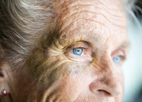 Sindrome occhio secco negli anziani: come prevenirla e curarla