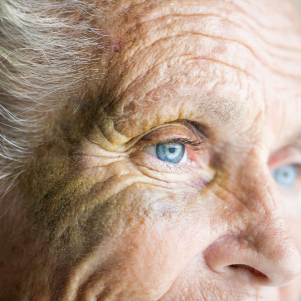 Sindrome occhio secco negli anziani: come prevenirla e curarla