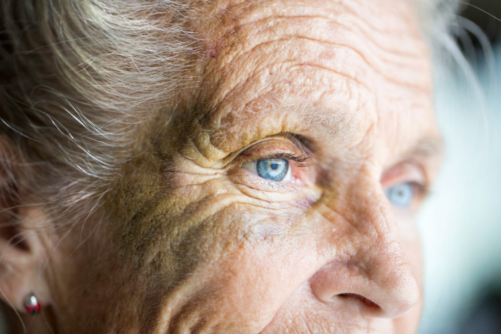 sindrome dell'occhio secco anziani